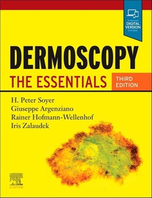 Dermoscopy.(3rd edition)