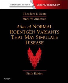 Atlas of Normal Roentgen Variants That May Simulate Disease Expert Consult - Enhanced Online Features and Print
