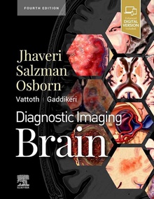 Diagnostic imaging brain