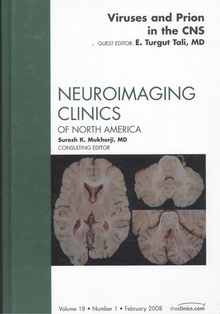 18 1 viruses and prion in the cns neuroimaging clinics of north volume 18 number 1 february 2008