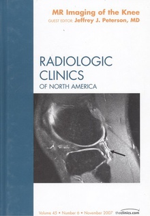 Mr imaging of the knee radiologic clinics of north america volume 45 number 6 november 2007