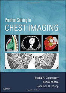 Problem solving in chest imaging