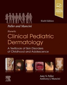 Paller and mancini:hurwitz clinical pediatric dermatology